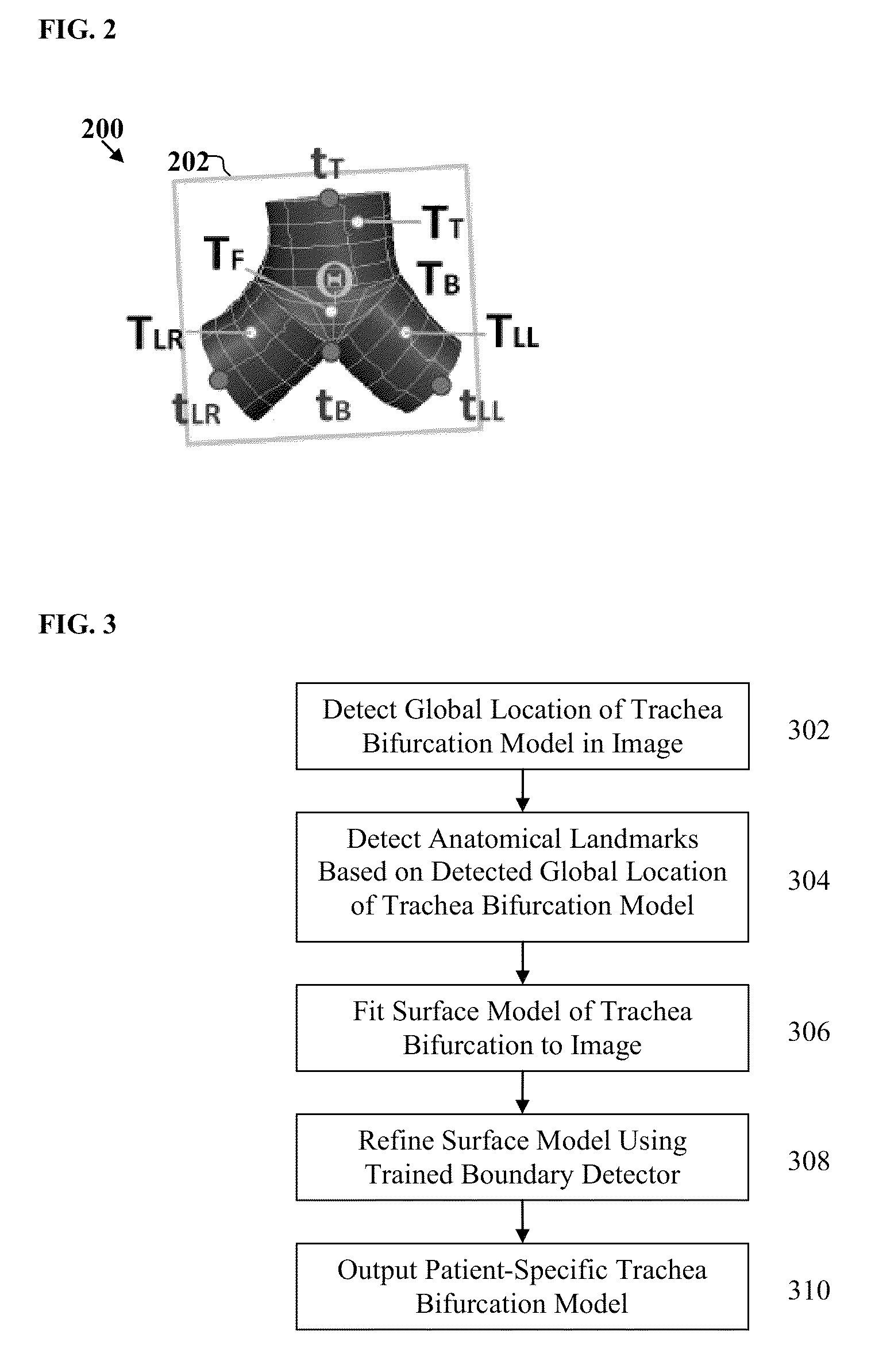 Method and system for model-based fusion of computed tomography and non-contrasted C-arm computed tomography