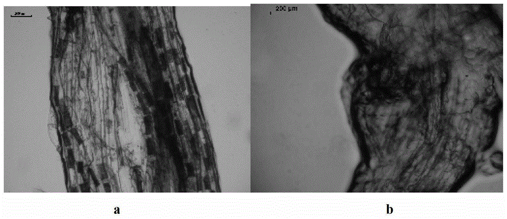 A Fast and Efficient Method for Staining Arbuscular Mycorrhizal Fungi