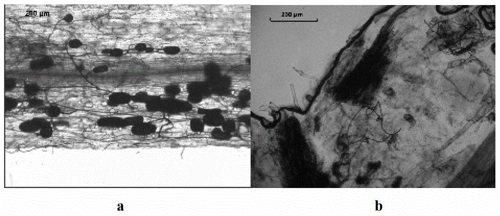 A Fast and Efficient Method for Staining Arbuscular Mycorrhizal Fungi