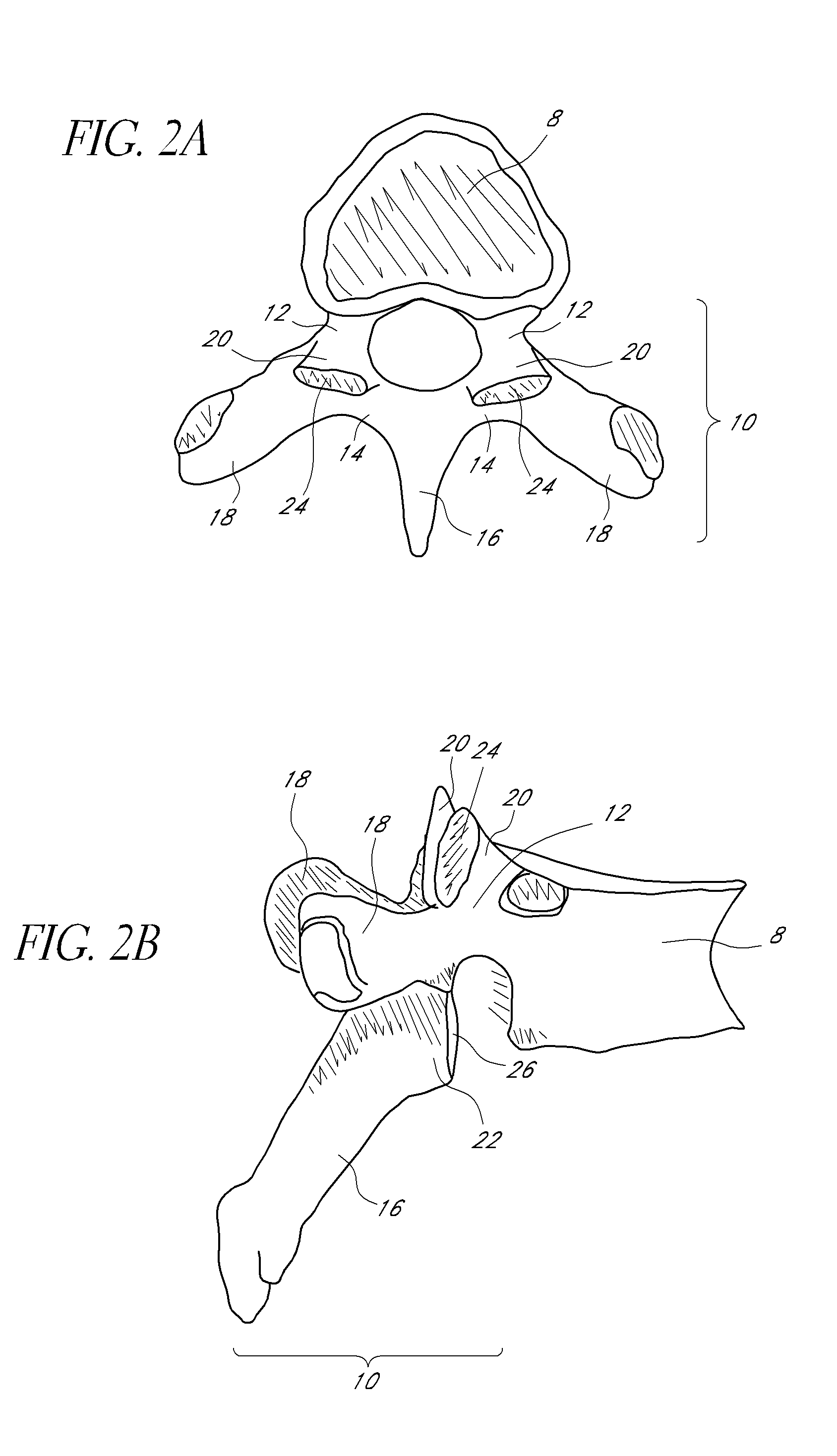 Transverse connectors