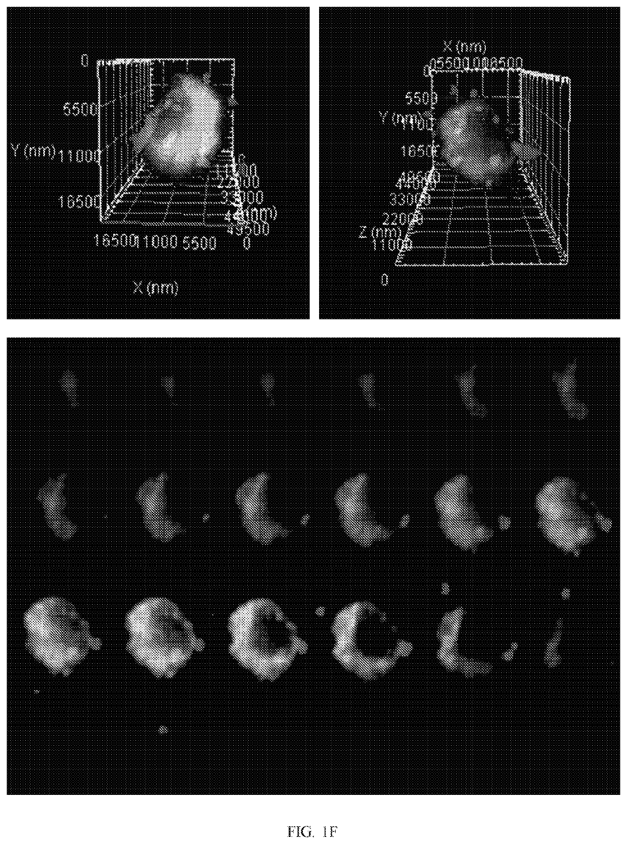 Combination cancer therapy using chimeric antigen receptor engineered natural killer cells as chemotherapeutic drug carriers