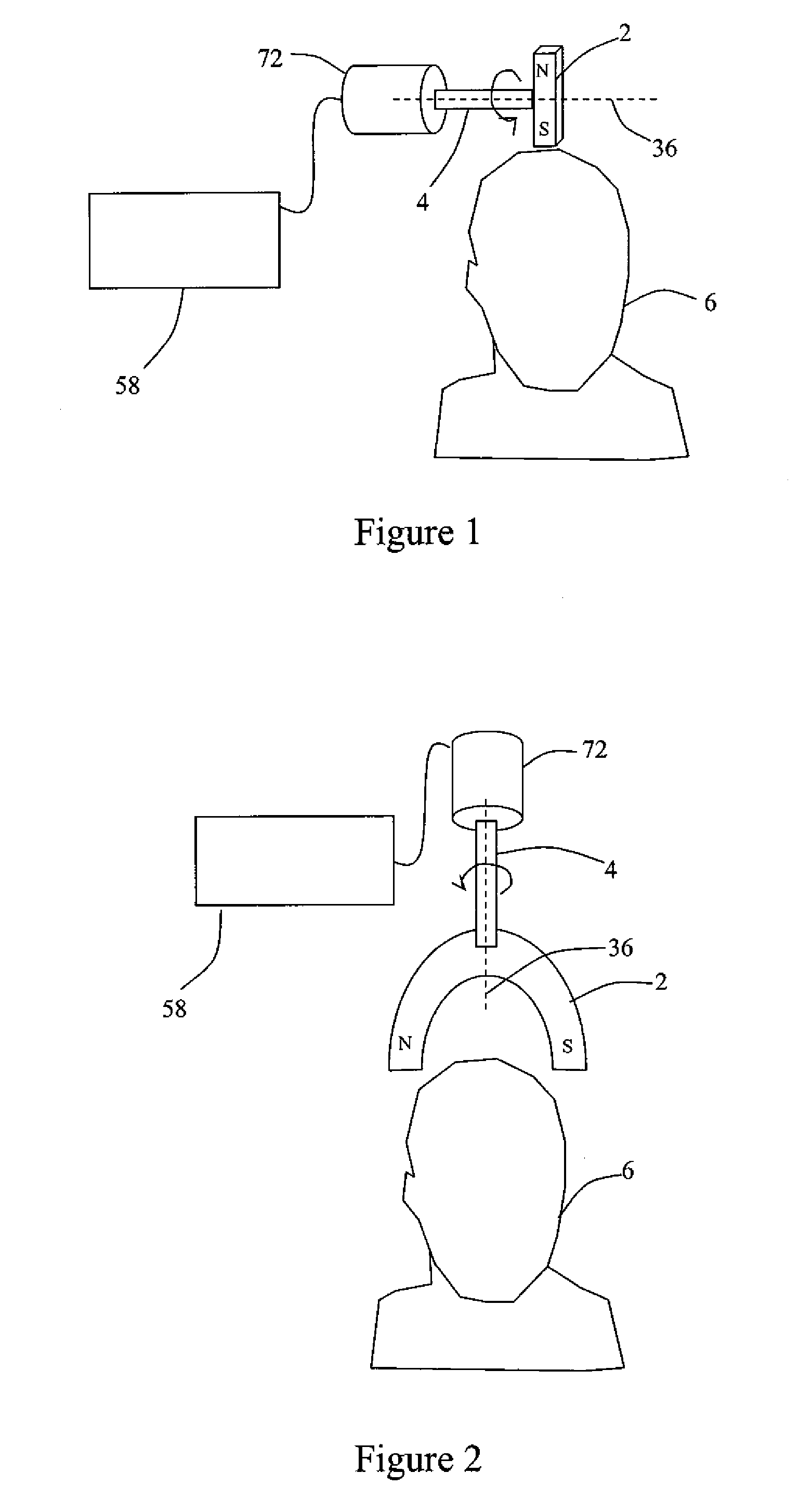 Systems and Methods for Anxiety Treatment Using Neuro-EEG Synchronization Therapy