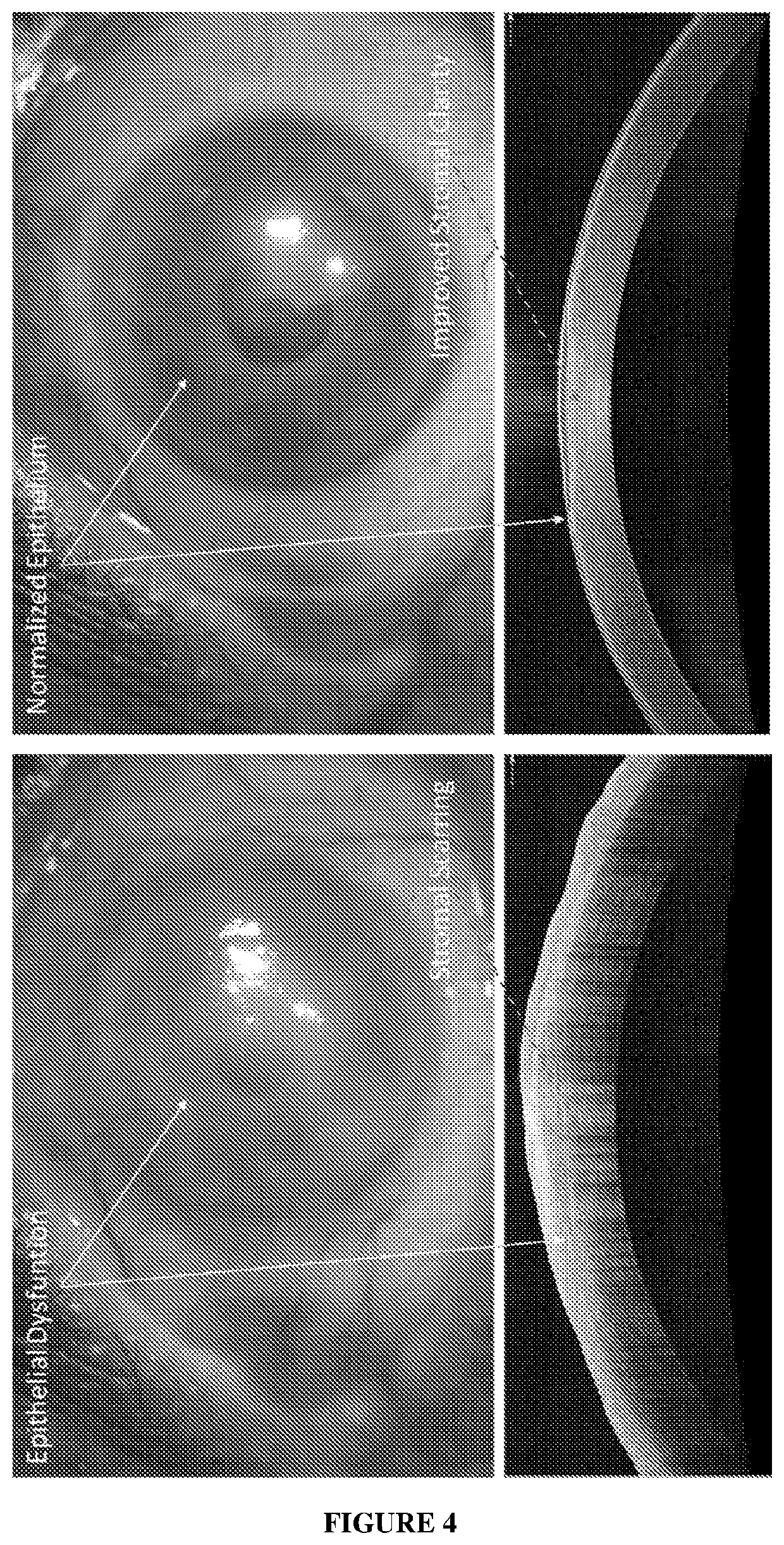 Cell Composition, Method of Production and its Use in Corneal Diseases