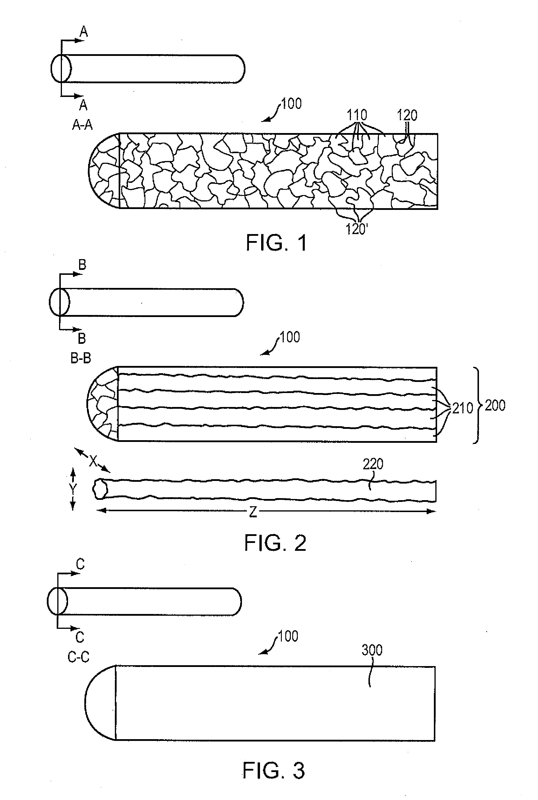 Magnesium-Based Absorbable Implants