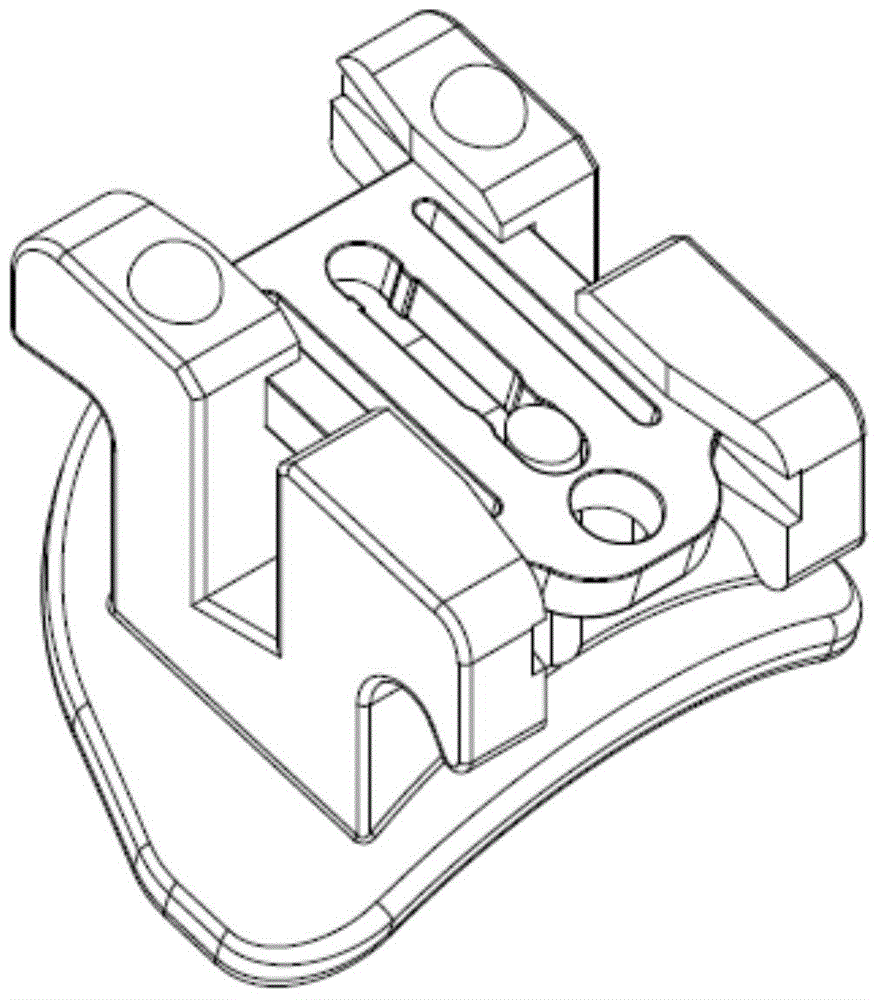 Conveniently-cleaned passive slip cover self-ligating bracket