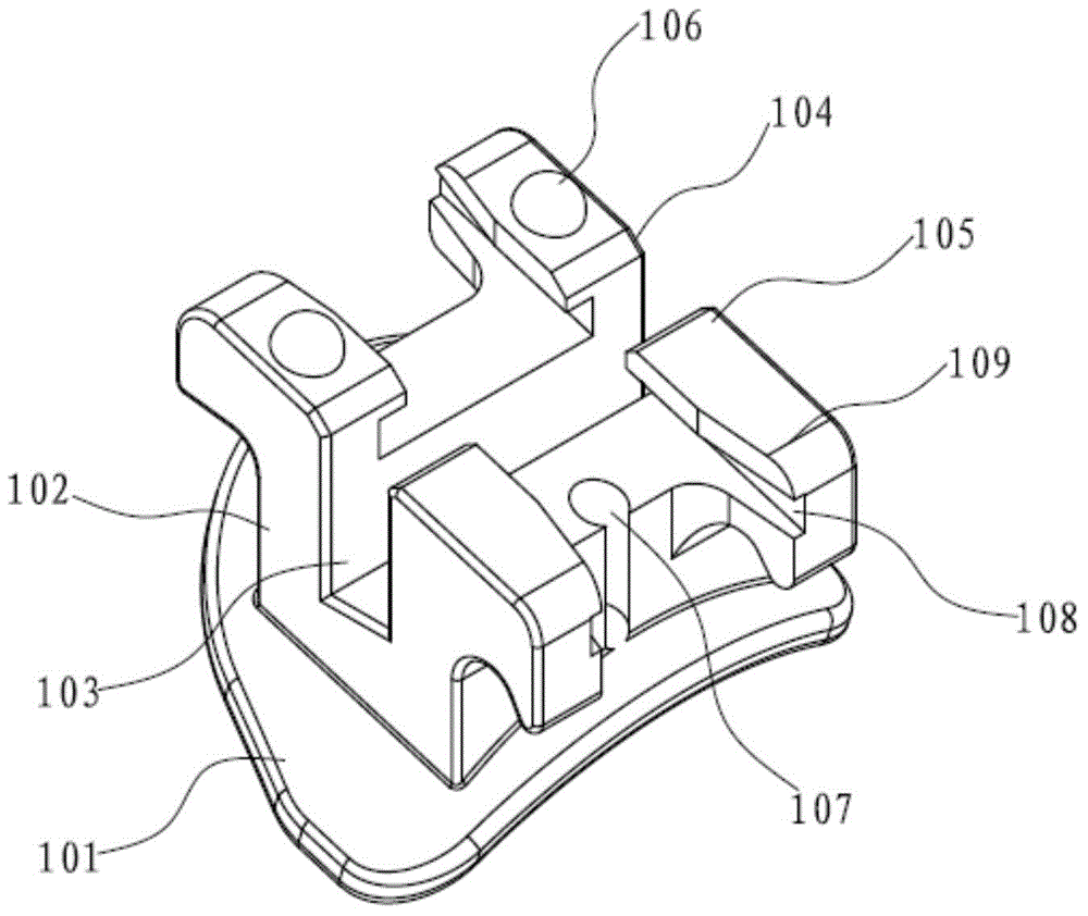 Conveniently-cleaned passive slip cover self-ligating bracket