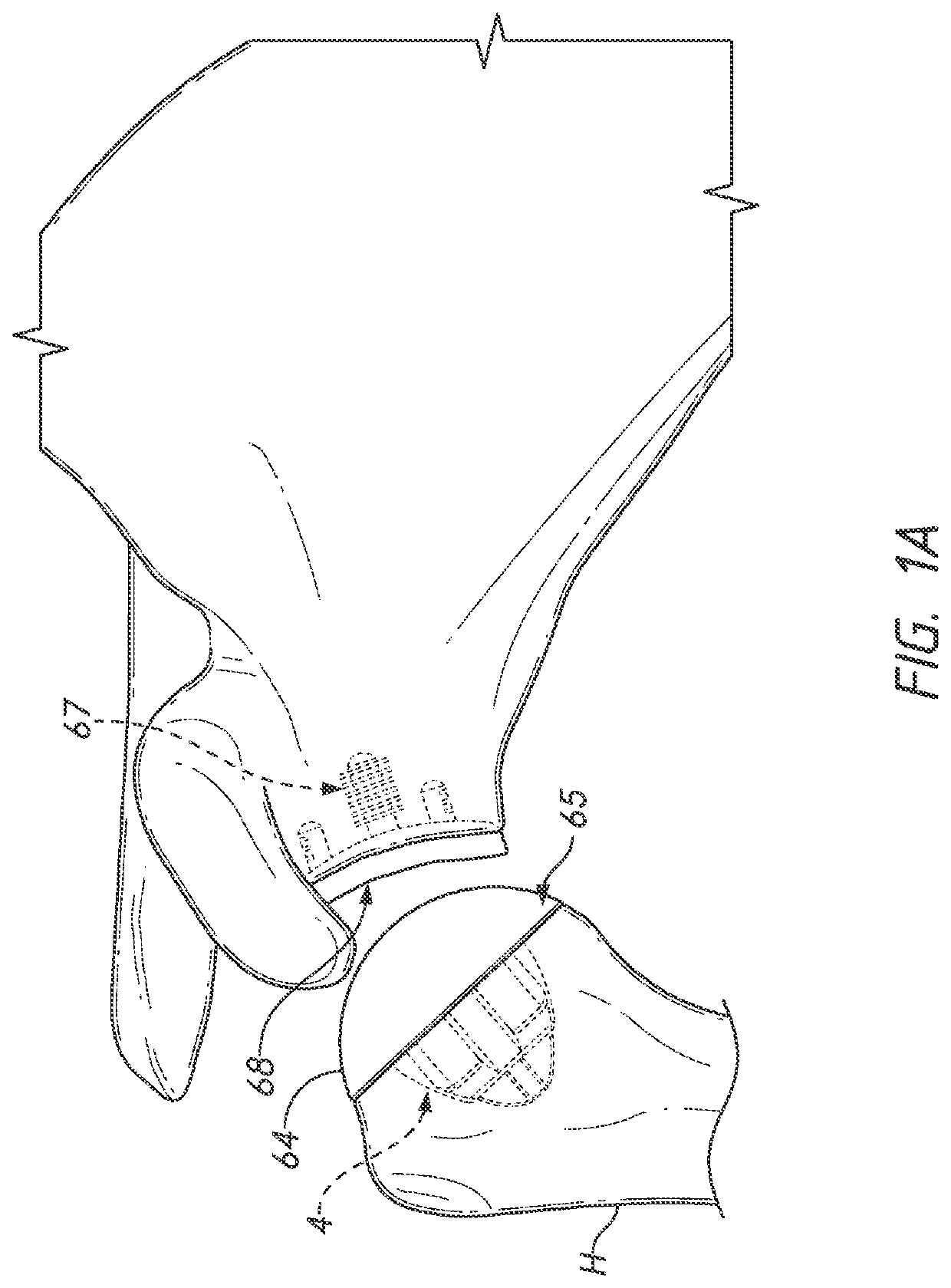 Shoulder prosthesis components and assemblies