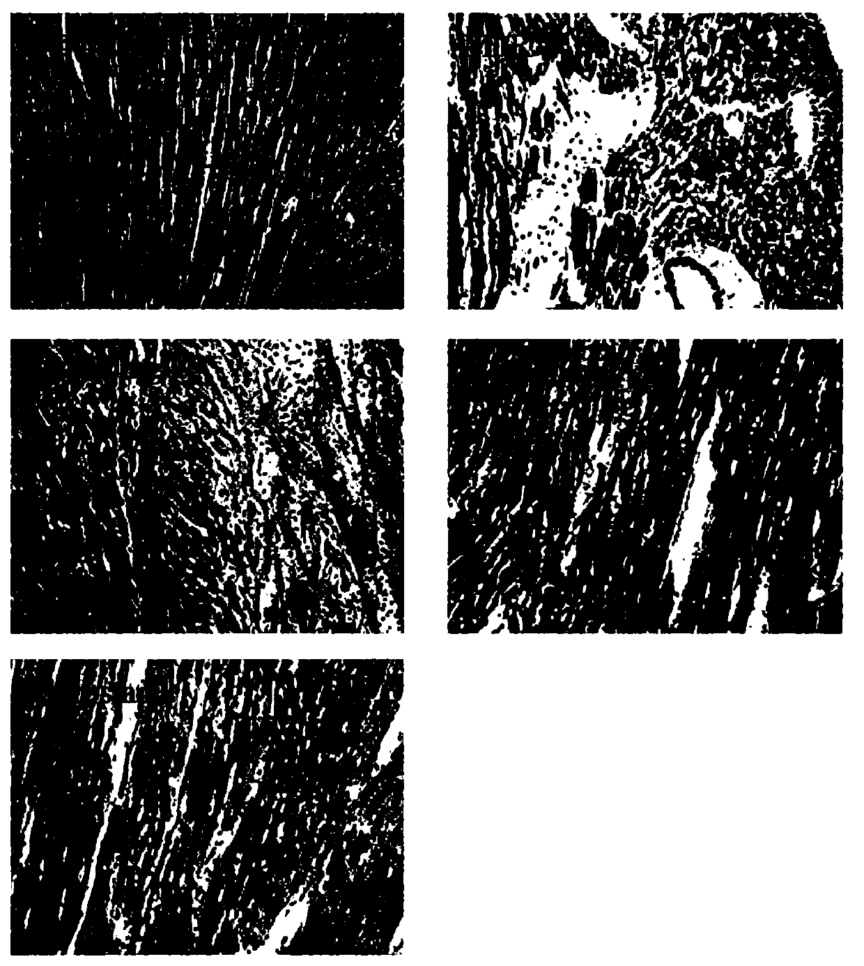 Preparation method and application of inonotus obliquus extract granules