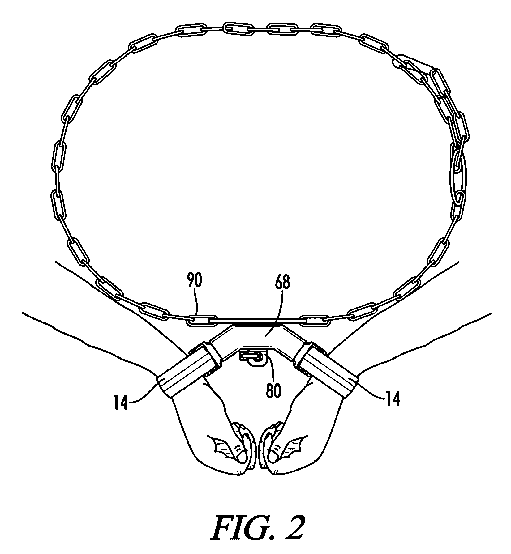 Inmate transport restraint