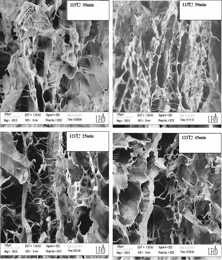 Tissue engineering bracket applicable to human body organ construction and preparation method thereof