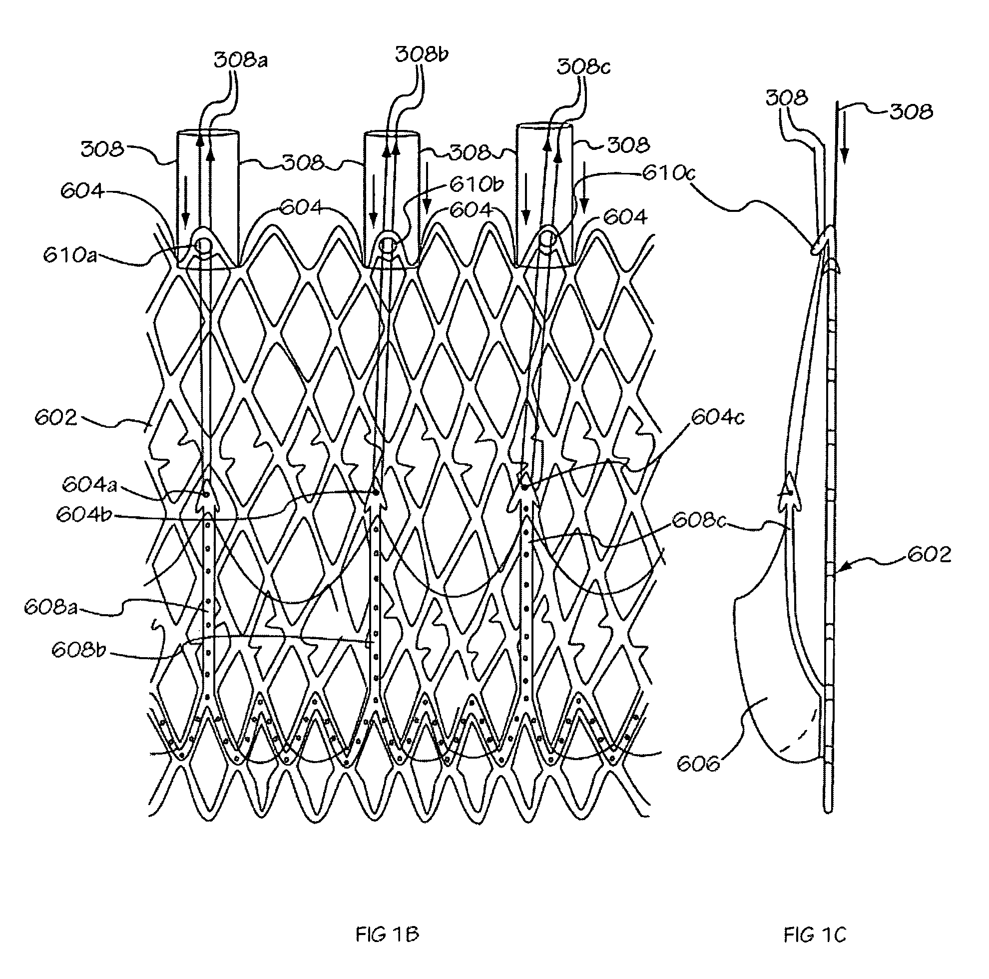 Medical implant deployment tool