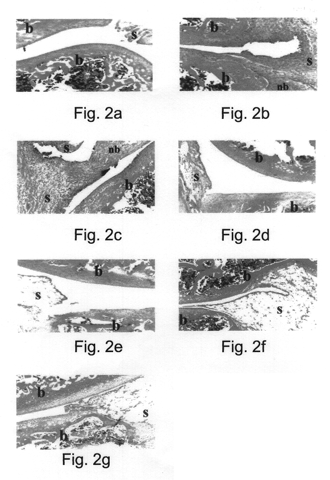 Polynucleotides encoding MIP-1alpha, MCP-1, MIP-1beta, Rantes and TNF-alpha, and methods for treating rheumatoid arthritis