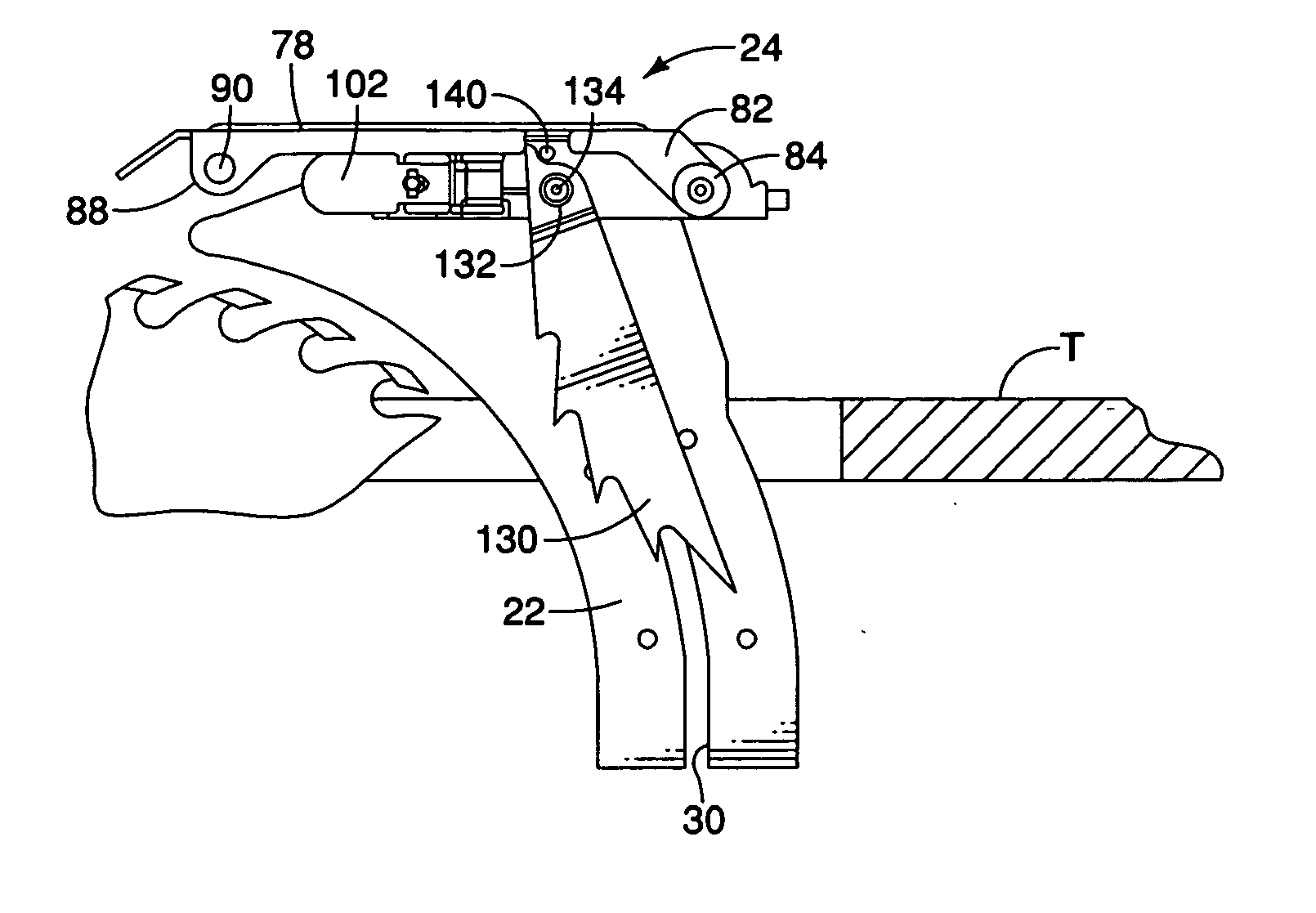 Modular guard system for a power saw