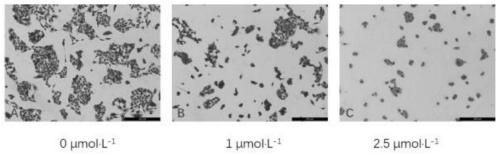 Application of disulfiram in preparation of drug for treating liposarcoma