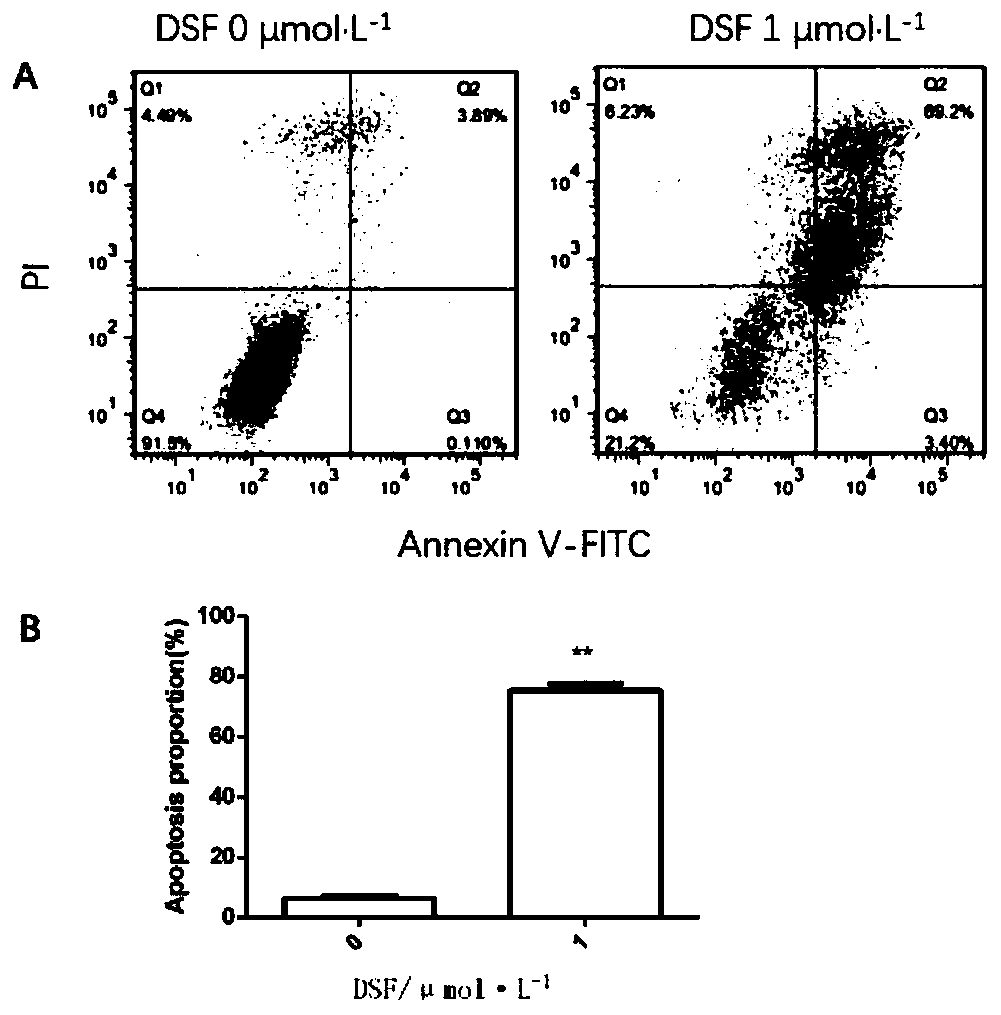 Application of disulfiram in preparation of drug for treating liposarcoma