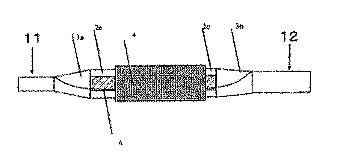 Stent delivery system