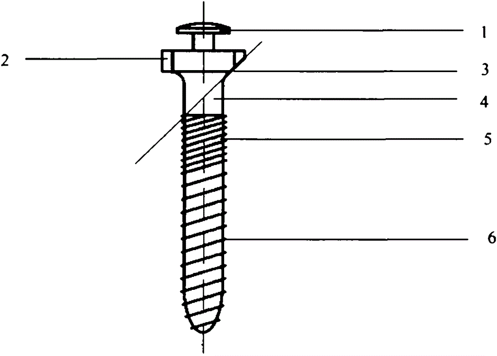 Orthodontic micro-implant anchorage nail