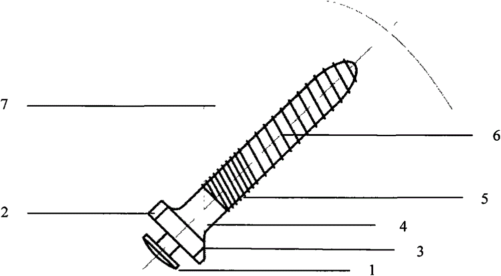 Orthodontic micro-implant anchorage nail