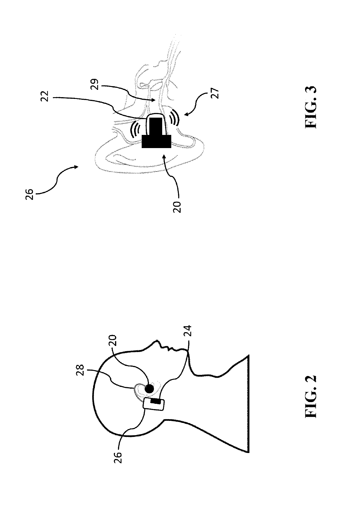 Ultrasonic hearing system and related methods