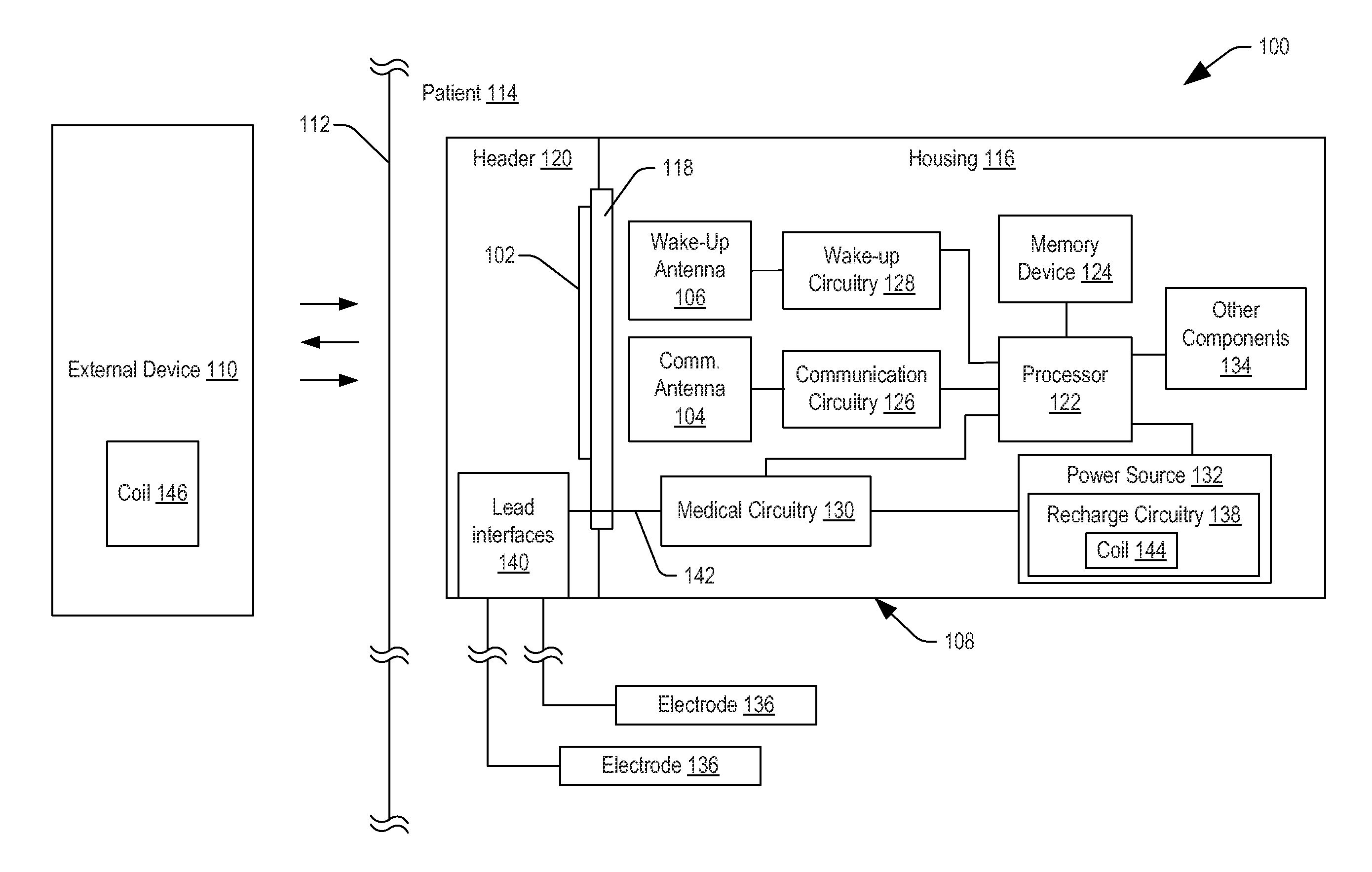 Antenna shield for an implantable medical device