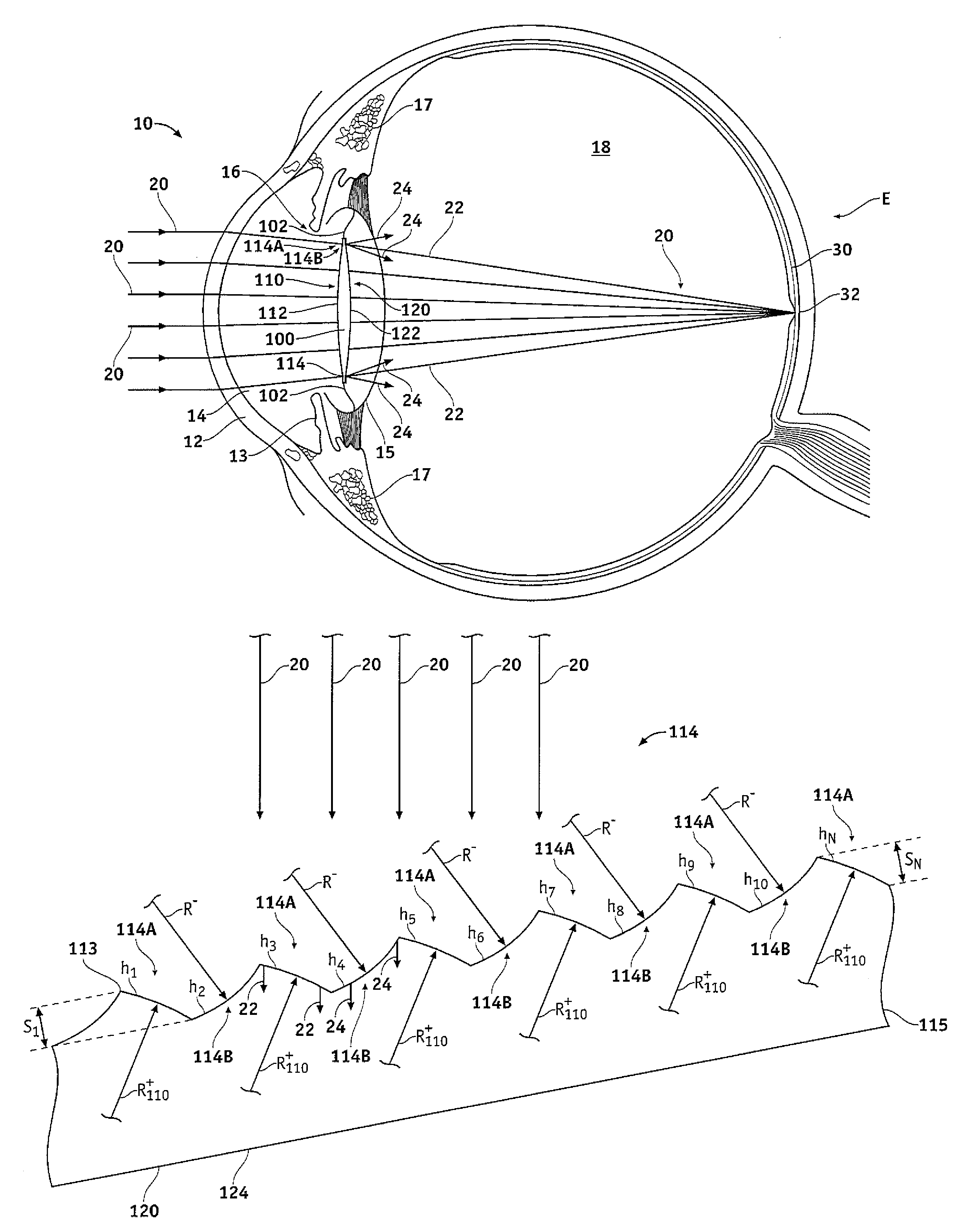 Microincision lens