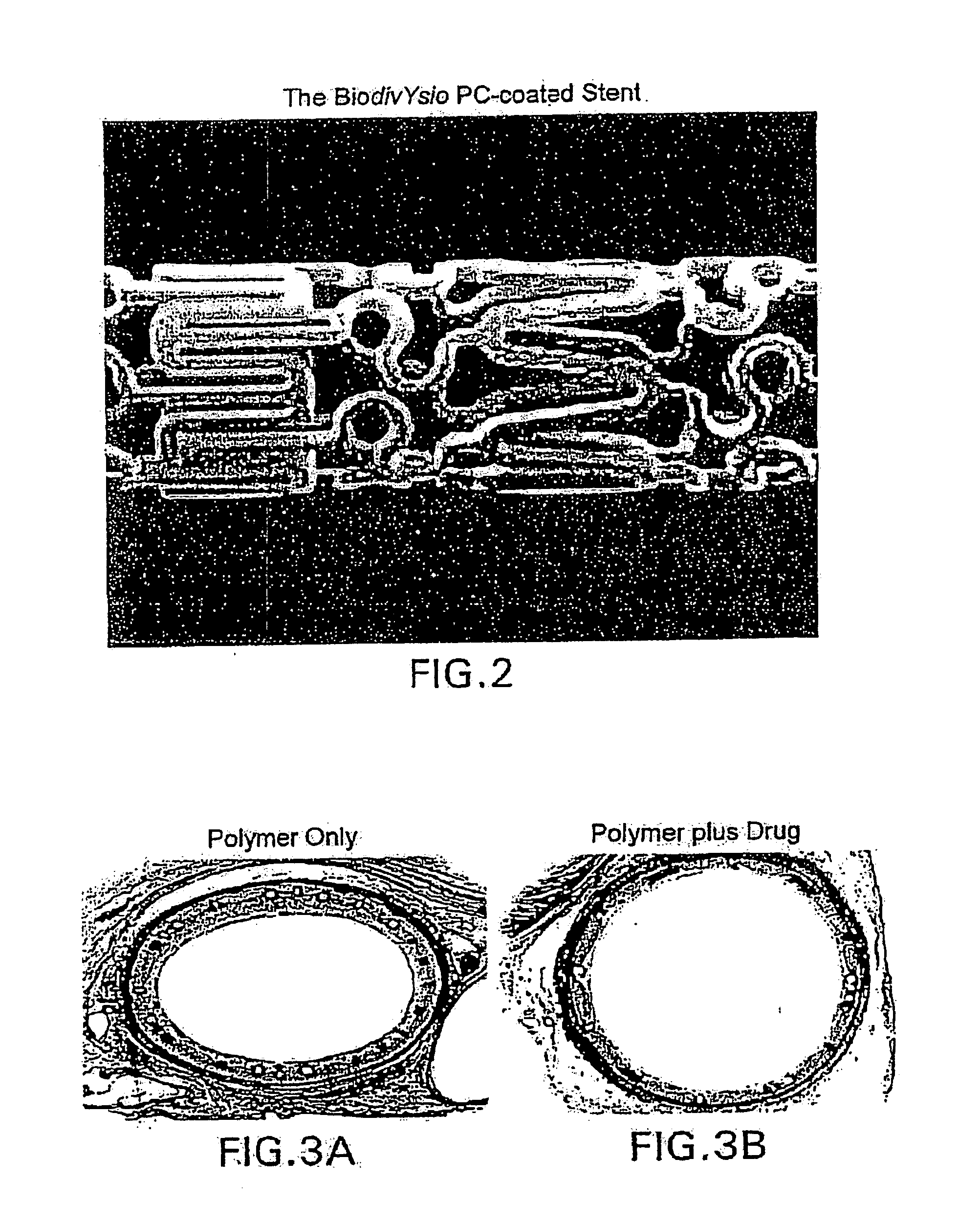 Method Of Treating Disorders Using Compositions Comprising Zotarolimus And Paclitaxel