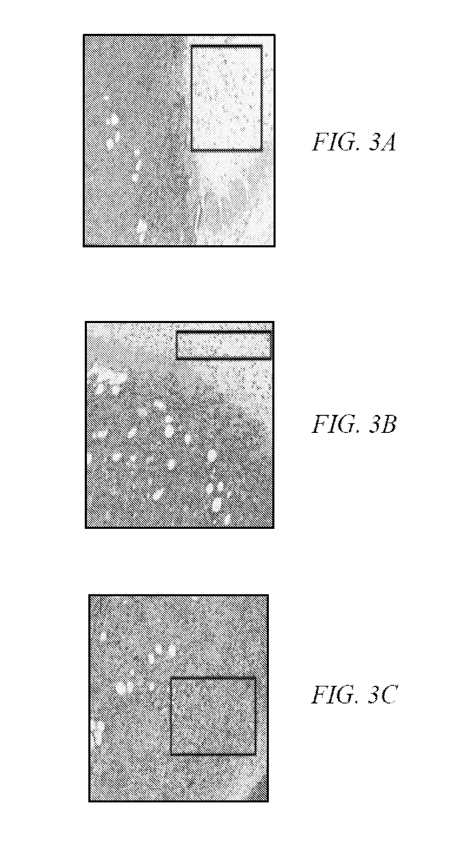 Method for the treatment of malignancies