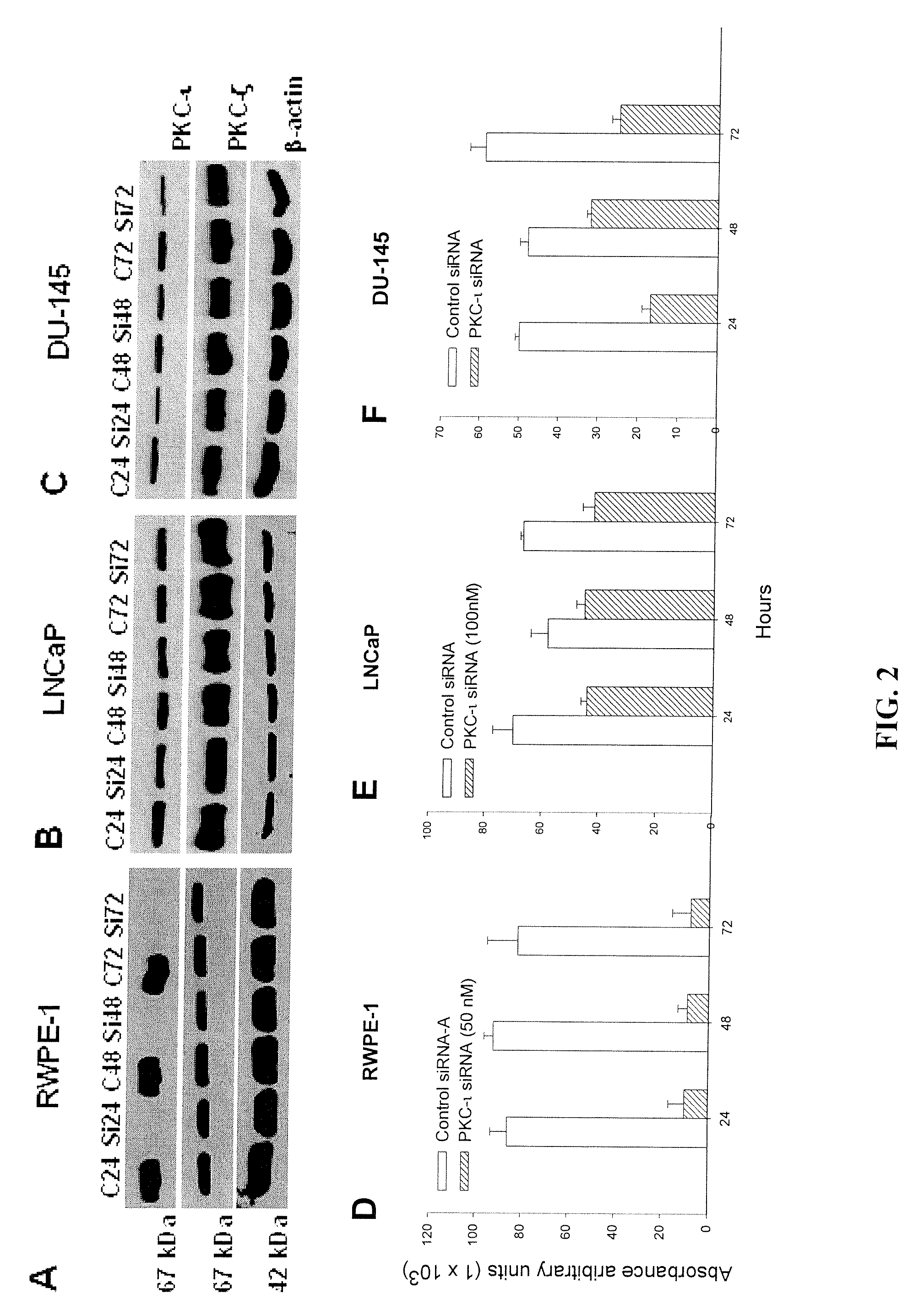 Prostate carcinogenesis predictor