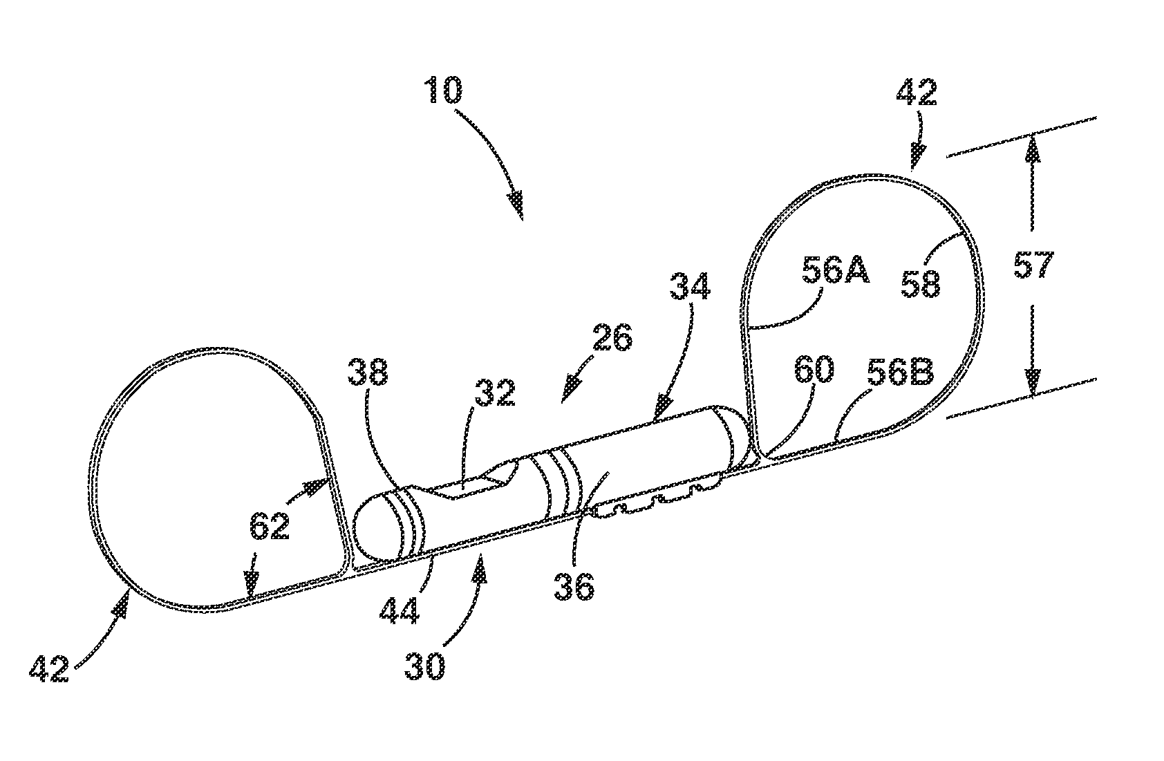 Implantable medical sensor and fixation system