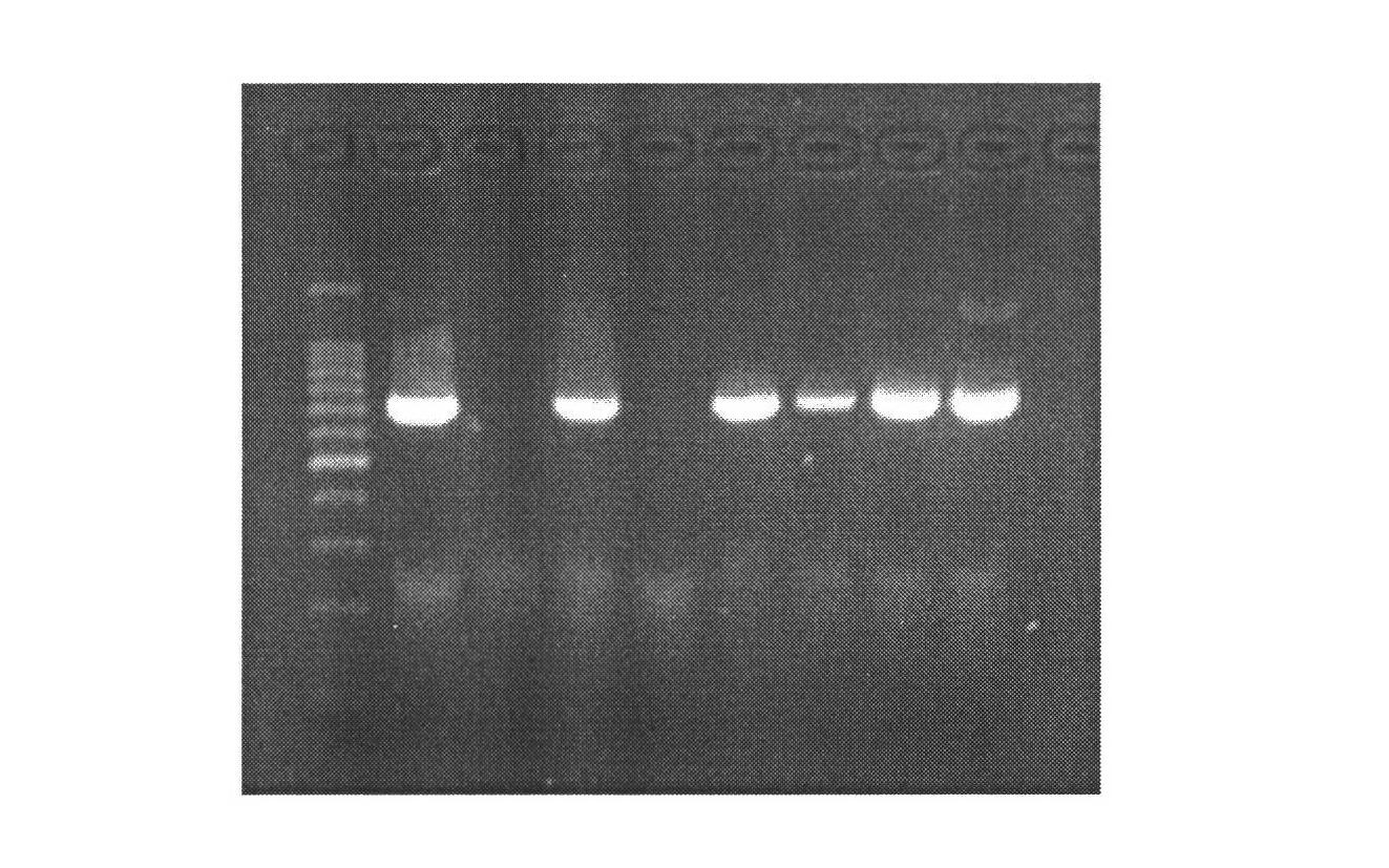 Method for constructing mammary gland specifically expressed human bactericidal/permeability-increasing protein (hBPI) vector