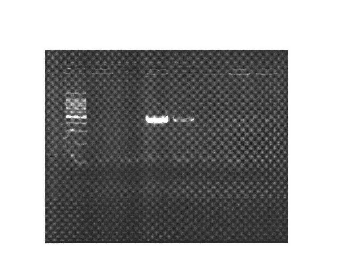 Method for constructing mammary gland specifically expressed human bactericidal/permeability-increasing protein (hBPI) vector