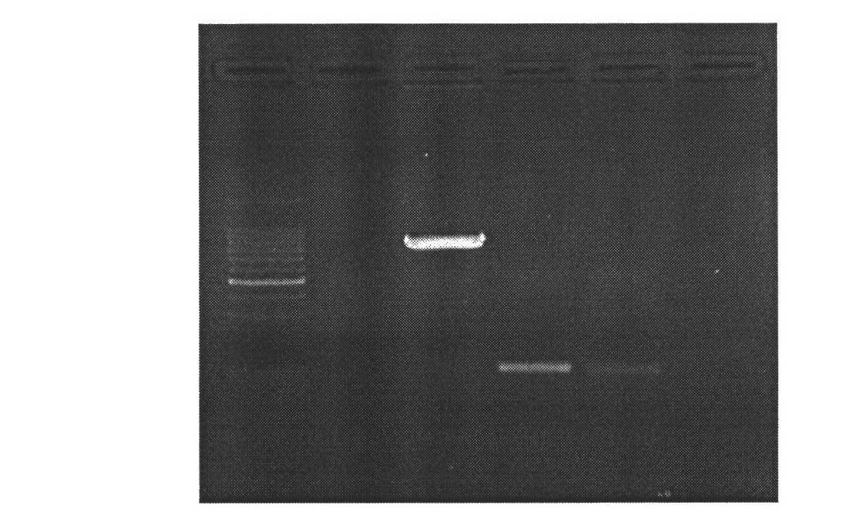 Method for constructing mammary gland specifically expressed human bactericidal/permeability-increasing protein (hBPI) vector