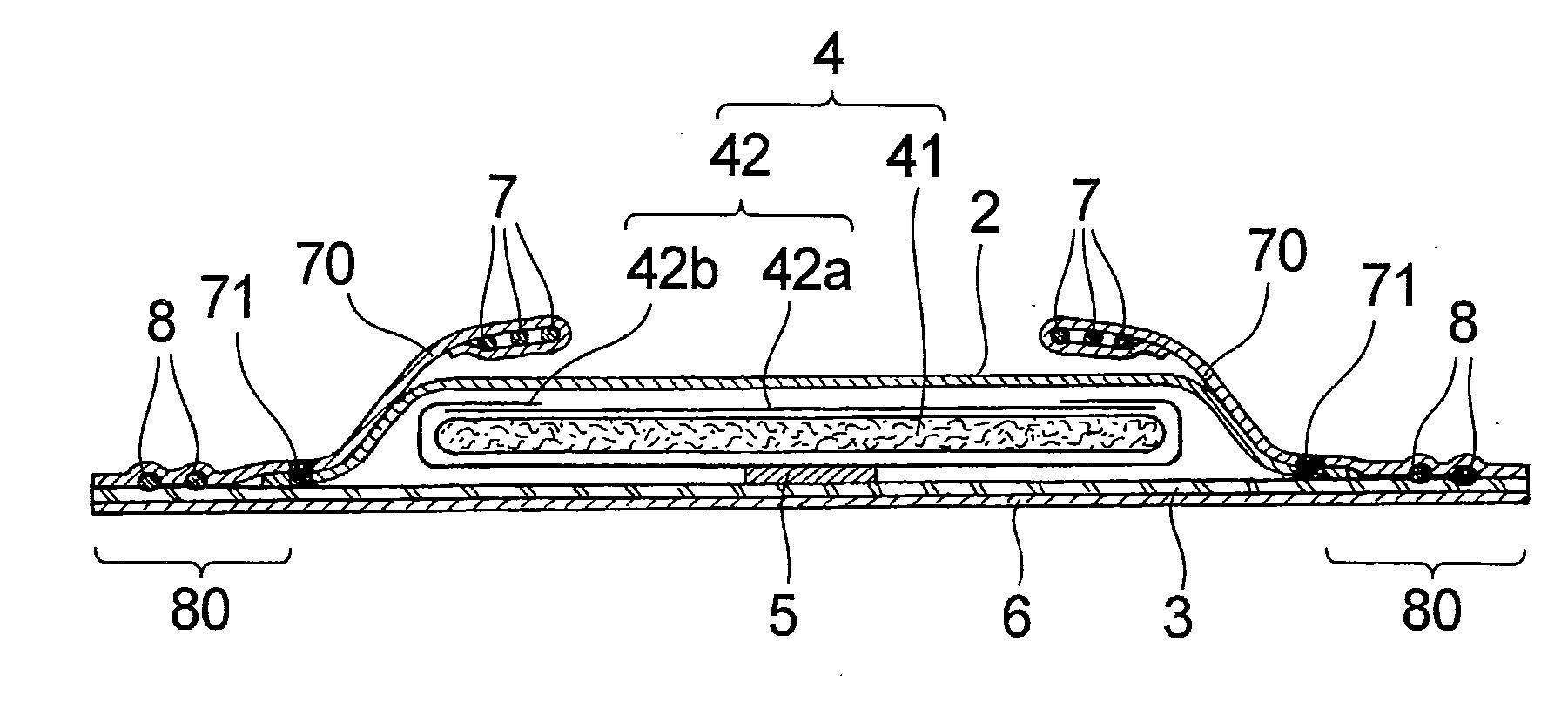 Absorbent article