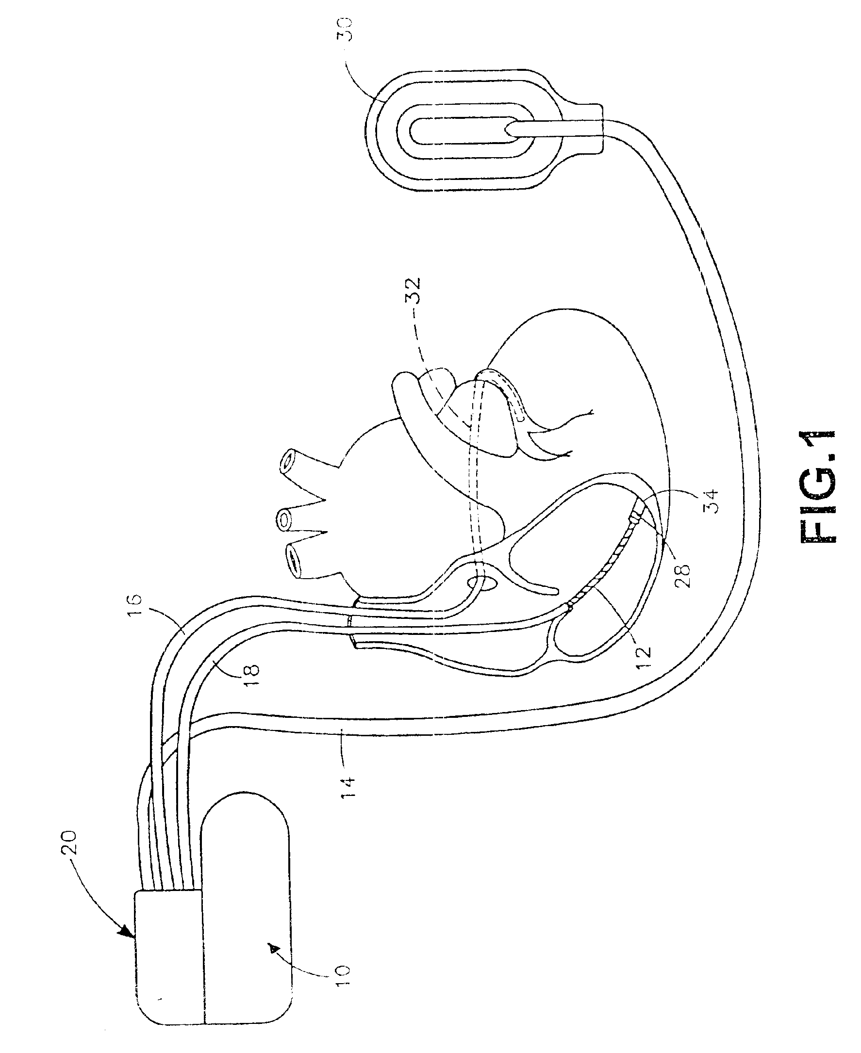 Methods of fabricating anode layers of flat electrolytic capacitors