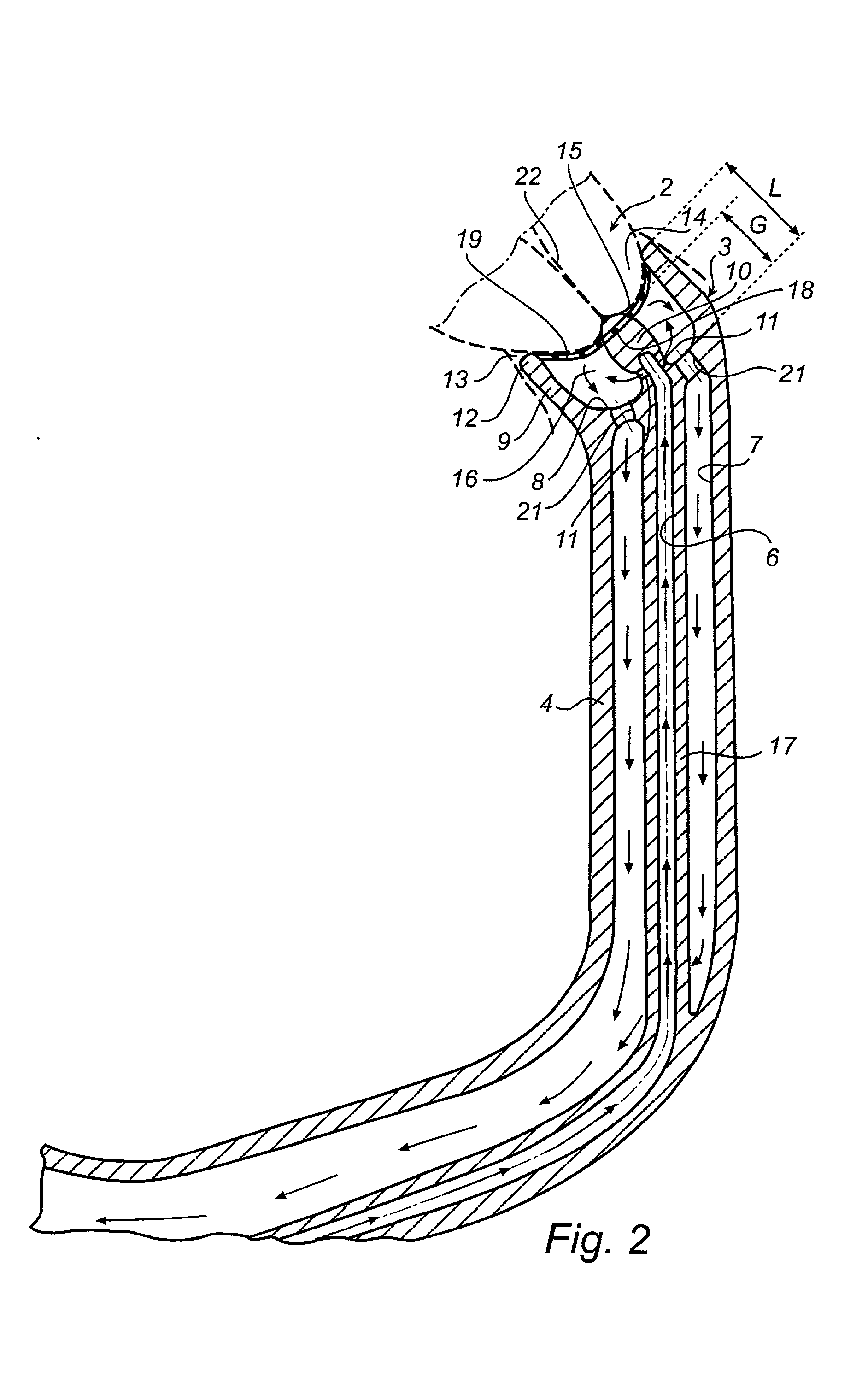 Method and device for treating inter alia the cervix