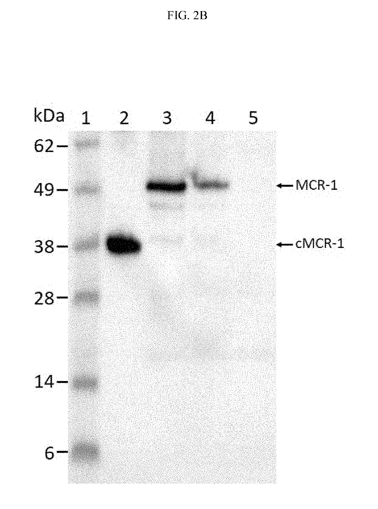 Antibodies for detection of colistin-resistance