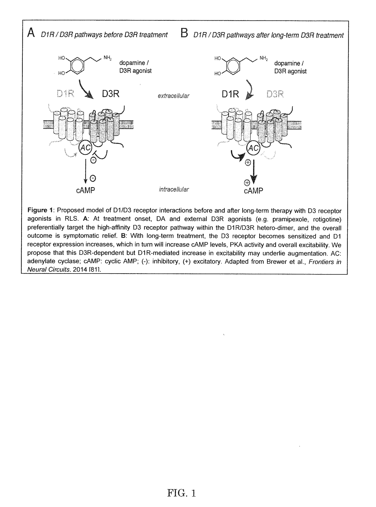 Treatment and management of augmentation in restless legs syndrome