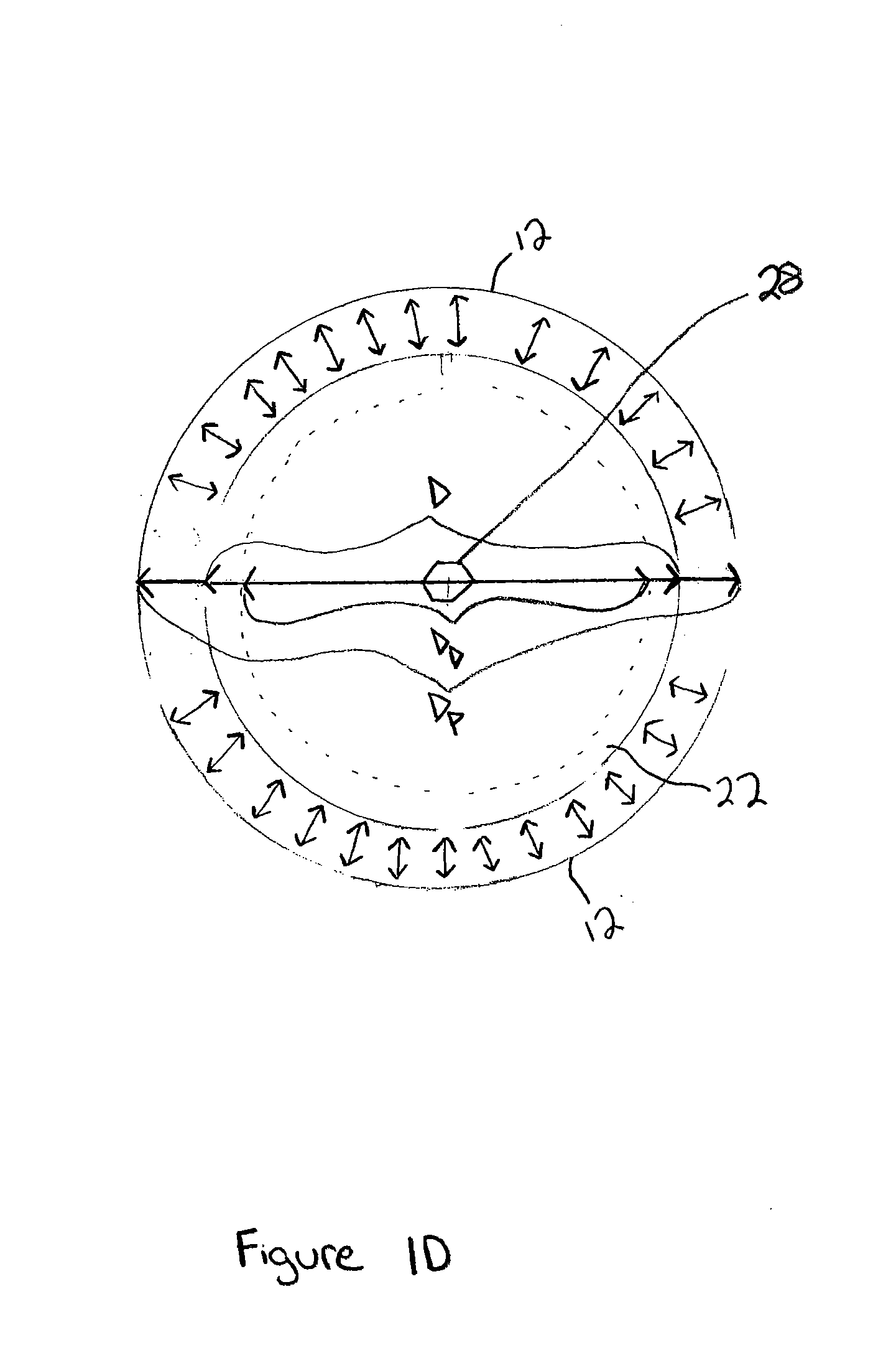 Facet fixation  and fusion screw and washer assembly and method of use