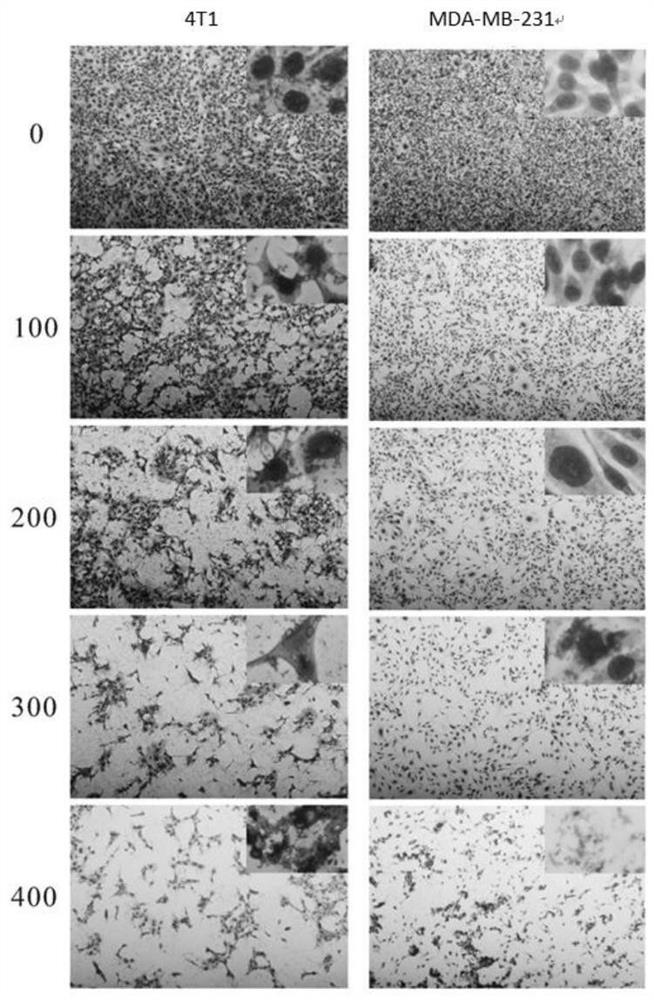 Preparation method of polysaccharide f212 and its application for preventing and/or treating breast cancer