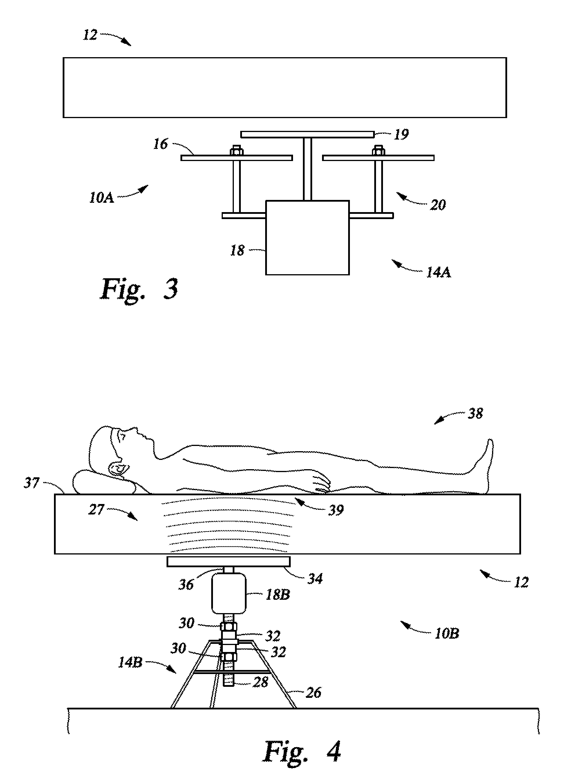 Device and method for treating nocturia