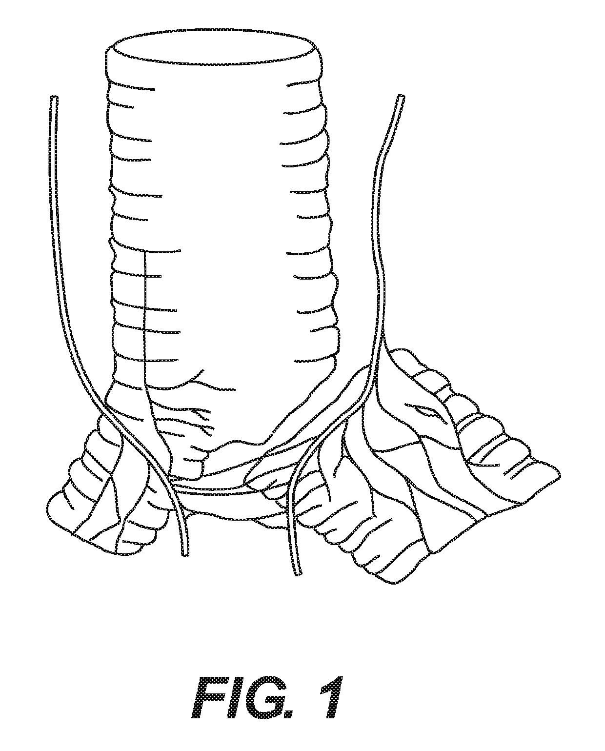 Neuromodulation device