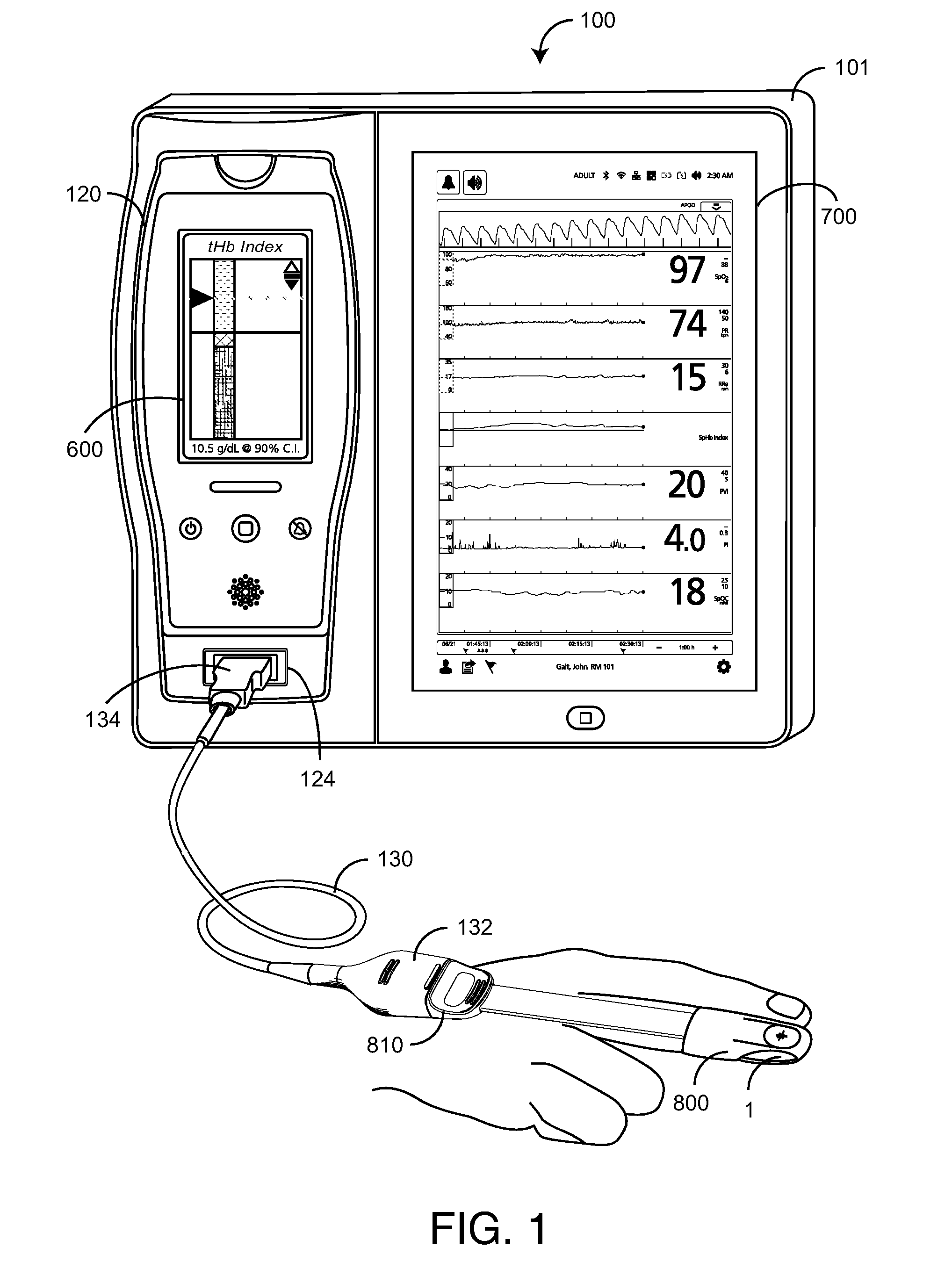 Total hemoglobin screening sensor