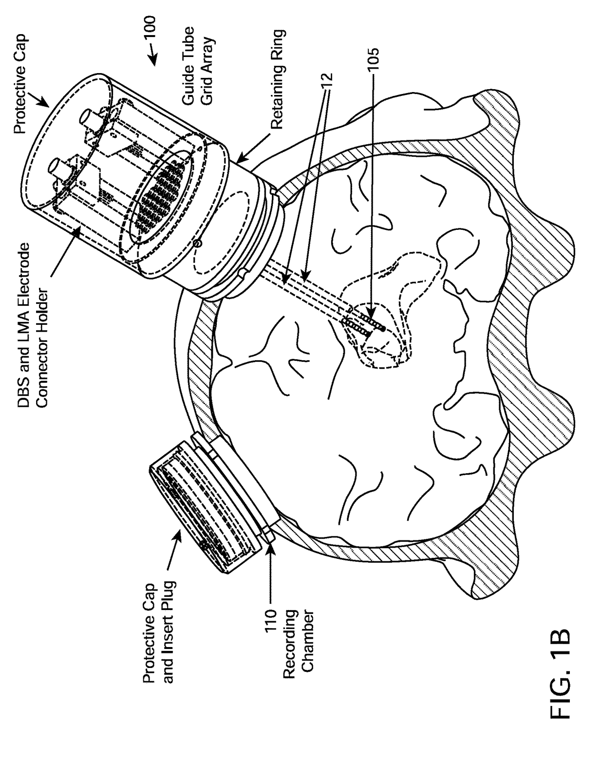 System and methods for multi-site activation of the thalamus