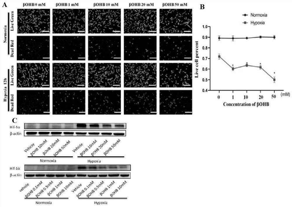 Application of HIF-1 alpha degradation inhibitor in preparation of drug for coronary heart disease with increased ketone body level