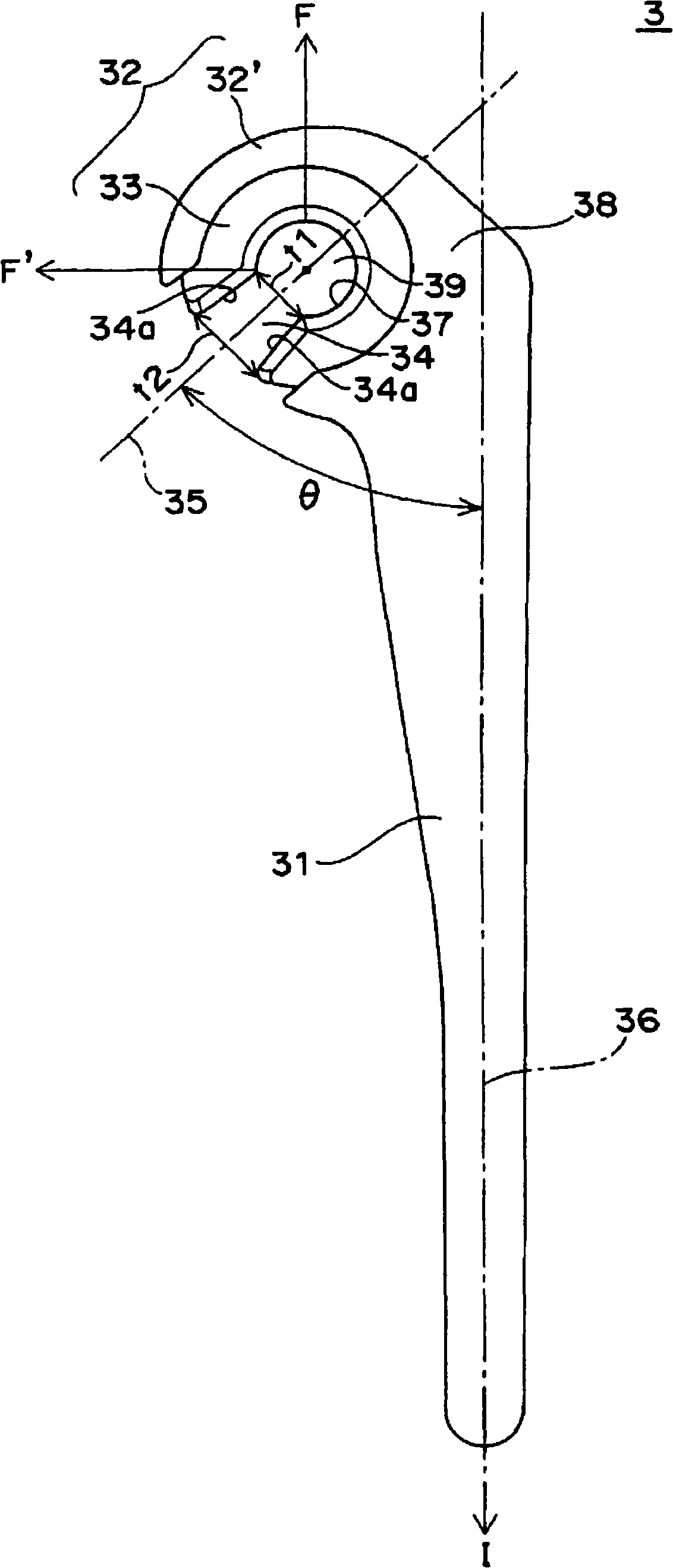 Artificial elbow joint