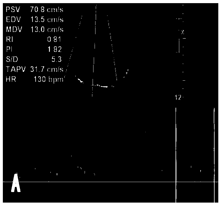 Fetal monitoring device and terminal equipment