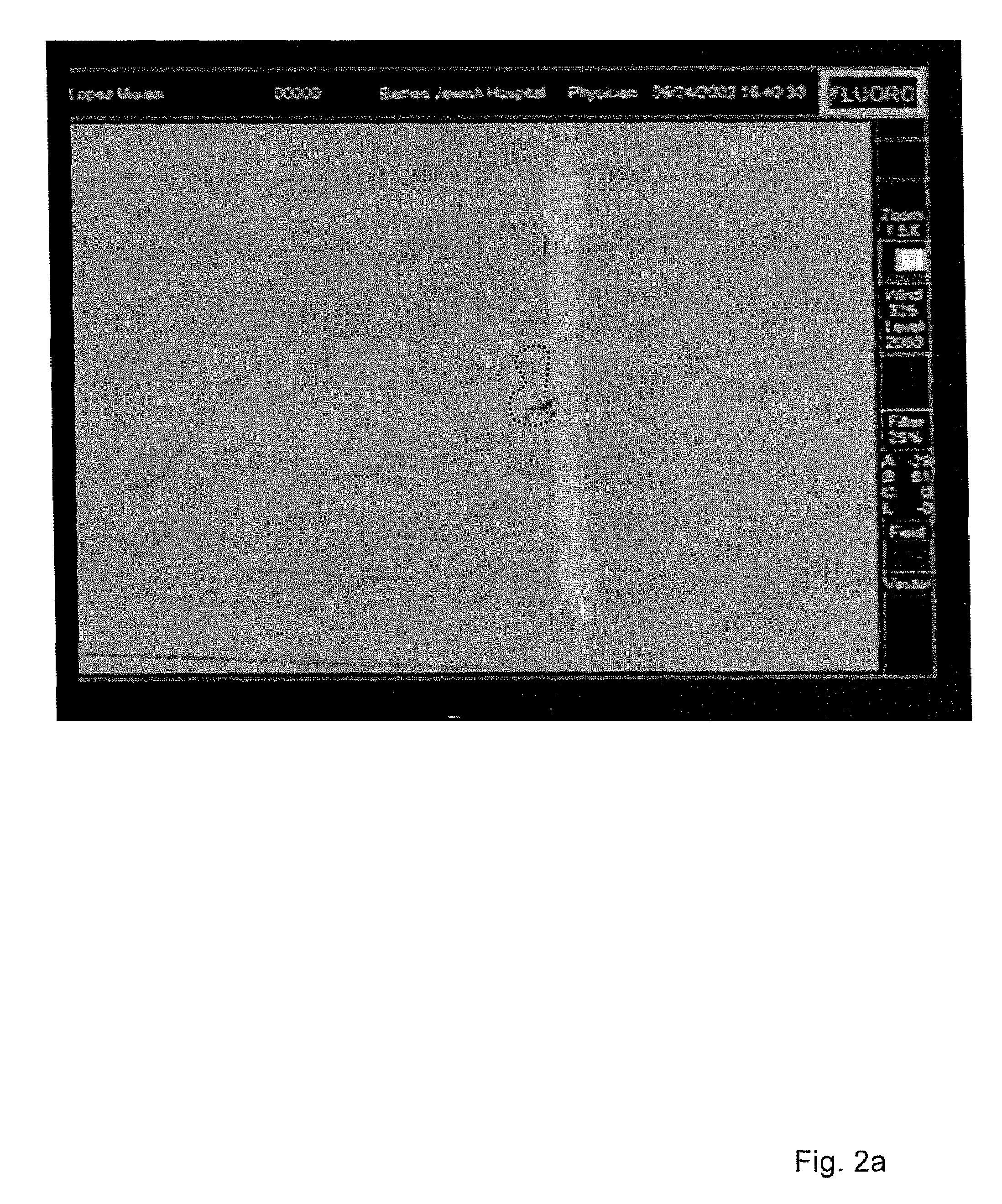 Method of navigating medical devices in the presence of radiopaque material