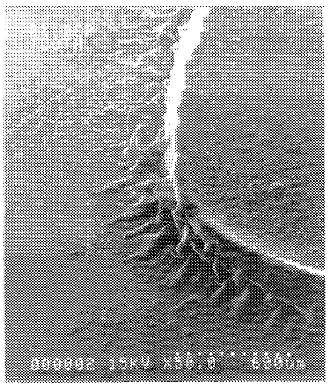 Orthodontic adhesive