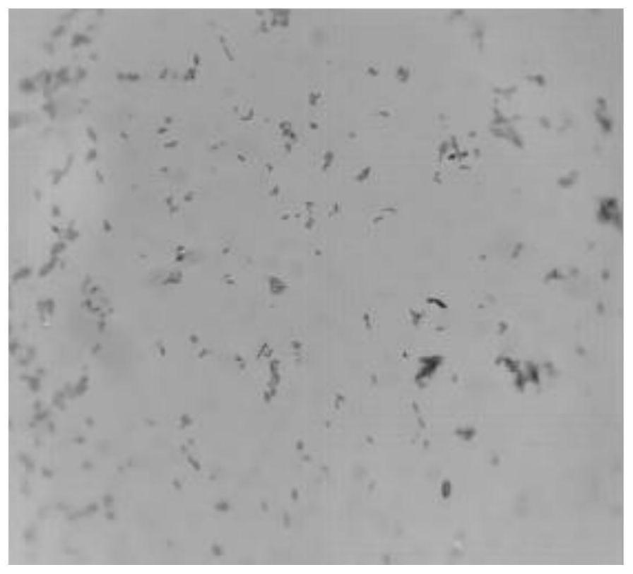 A strain of Lactobacillus plantarum and its application in preparing medicine or food for alleviating diseases caused by hyperlipidemia