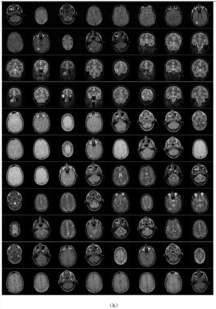 A Large-Scale Medical Image Retrieval Method Based on Random Sparse Coding